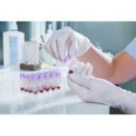 HEALTHCARE - IVD : Toxicology Screening - Urine Analysis - POCT