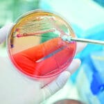 Article image of: The Wide Application of Escherichia coli Fermentation in Microbiological Research