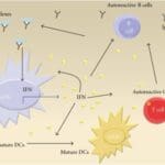 Article image of: Cytokine Systemic Lupus Erythematosus Cytokines Assay Solutions