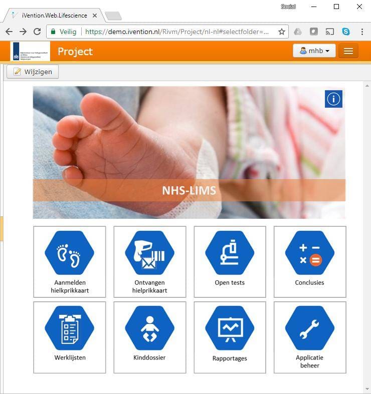 Article image of: New LIMS for the Dutch Neonatal Blood Spot Prick Screening