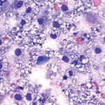 Article image of: TECHNIDATA announces a new version of TD HistoCyto software