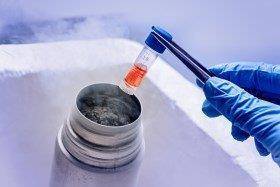 Article image of: Geautomatiseerde opslag voor biobank en patiënt