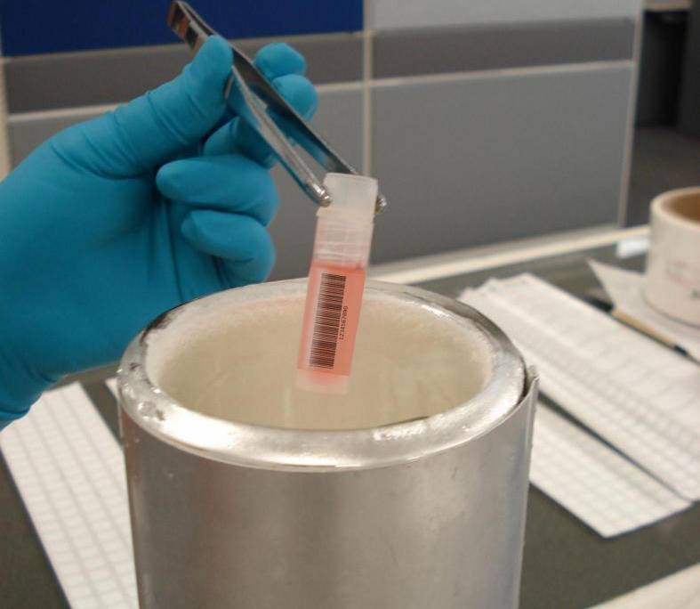 Article image of: Transparant label voor de identificatie van cryo-stalen