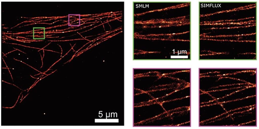 Article image of: Superresolutiemicroscopie 2 x zo scherp