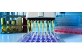 Article image of: DNA Library Preparation Kits to Meet Illumina Sequencing Needs