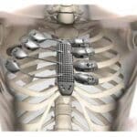 Article image of: Widest Choices for 3D Printing Materials by Alfa Chemistry