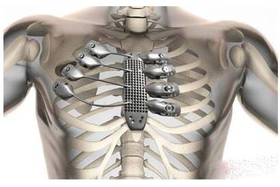 Article image of: Widest Choices for 3D Printing Materials by Alfa Chemistry