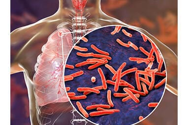 Article image of: Solutions to Accelerate Your Study in Microecology and Human Health