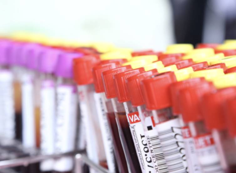 Article image of: Studie naar covid-19-besmettingen in belgische zorg