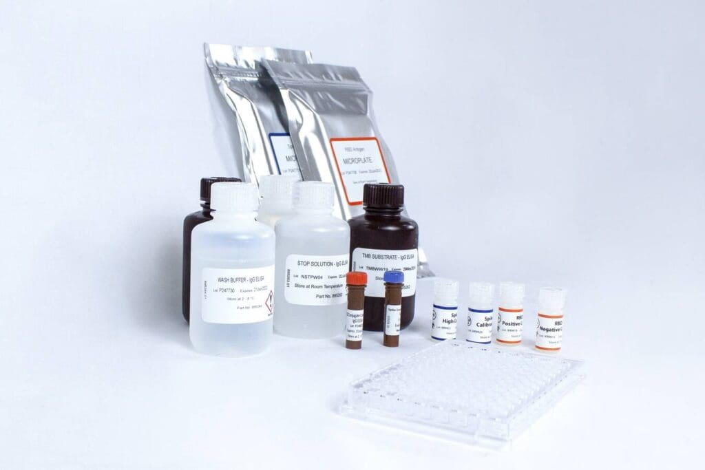 Article image of: EKF introduces accurate quantitative COVID-19 antibody test kit