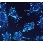 Article image of: New Nanoparticle Can Kill Cancer Cells Efficiently And Selectively