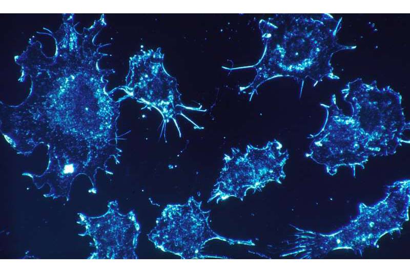 Article image of: New Nanoparticle Can Kill Cancer Cells Efficiently And Selectively