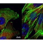 Article image of: Sacituzumab Govitecan, An ADC Drug Against Breast Cancer