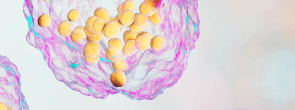 Article image of: Lipidomics Platform for MALDI-Imaging