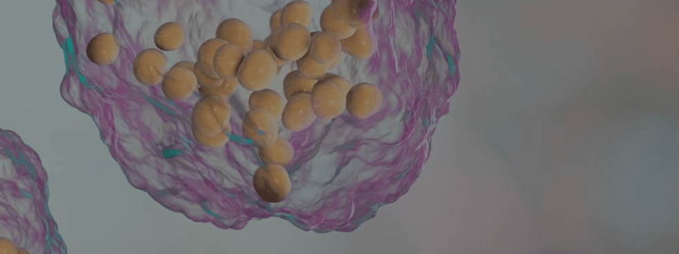 Article image of: Microbial Untargeted Lipidomics Service