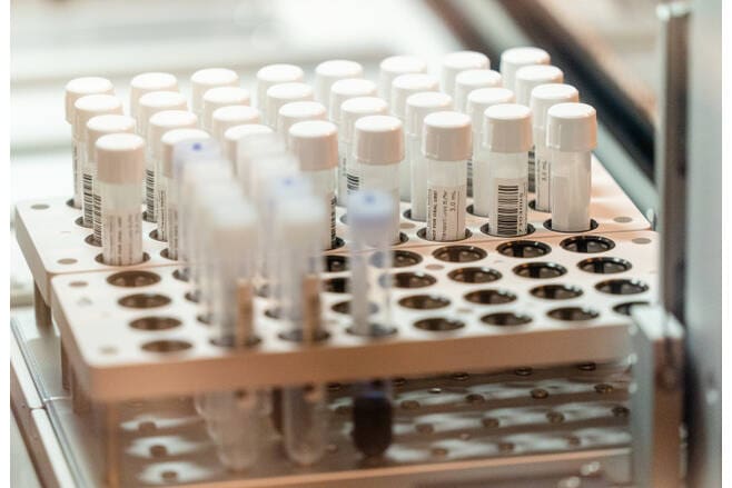 Article image of: Eurofins launches variant of concern-discriminating PCR Test