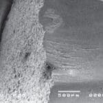 Article image of: Failure Analysis of Artificial Implanted Bone Plate Material