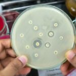 Article image of: Nieuwe antibacteriële middelen in strijd tegen antibioticaresistentie