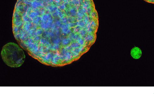 Article image of: Gelomics 3D extracellulaire matrixen: consistent, gebruiksvriendelijk en flexibel