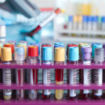 NHP Cerebrospinal Fluid (CSF) Products