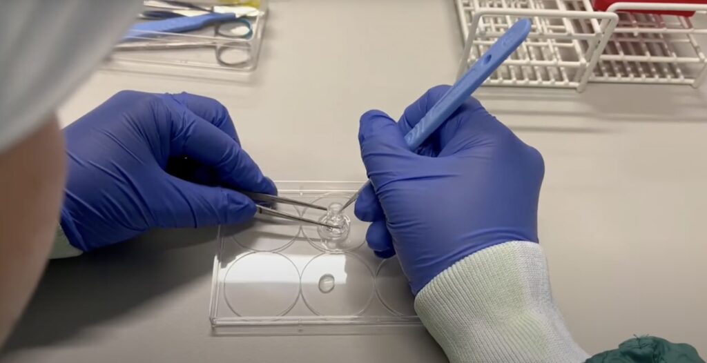 Article image of: Organoids: miniatuur lab-organen voor mensgericht en proefdiervrij onderzoek