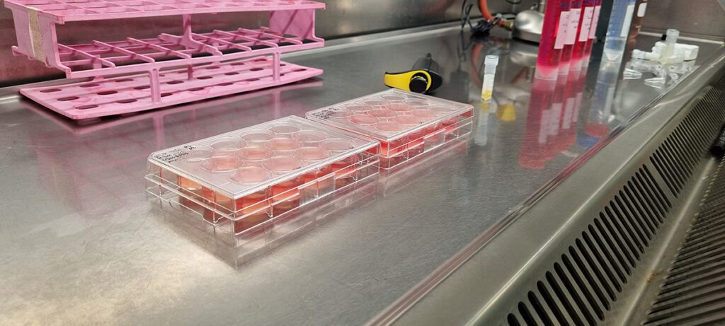 Kweekplaat met cellen