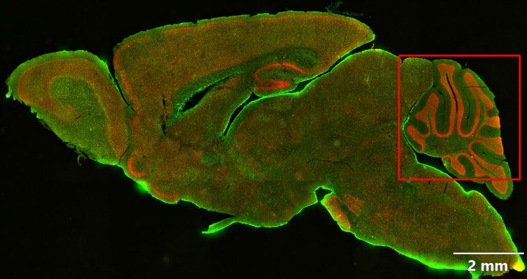 Article image of: How to Get Better Images from Deep within Your Sample?