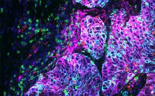 Article image of: How to Get Better Images from Deep within Your Sample?