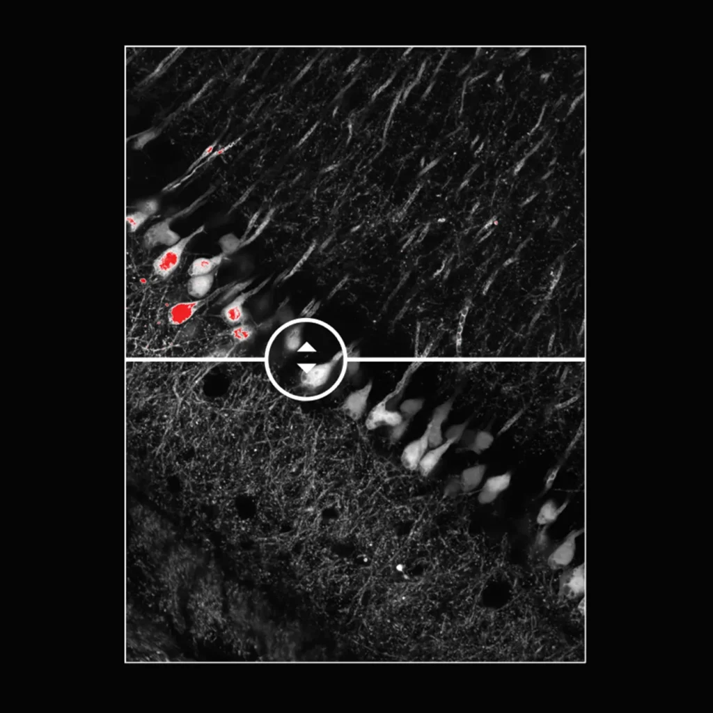 Article image of: Ontdek de kracht van een nieuwe standaard in confocale laserscanningmicroscopie
