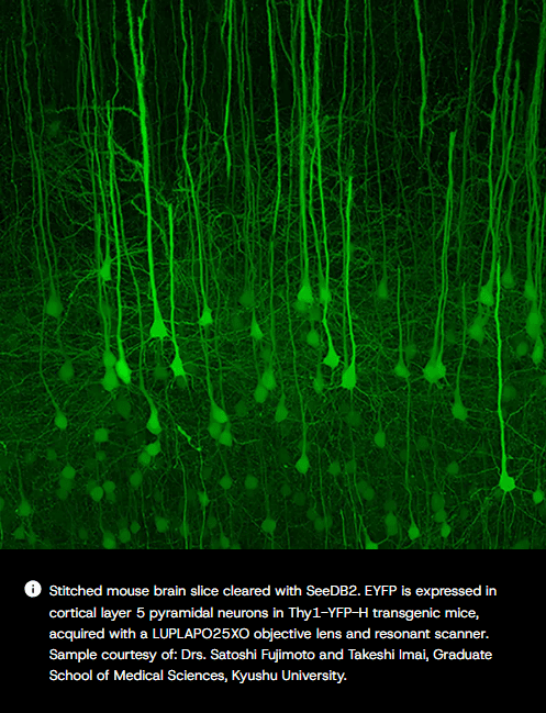 Article image of: Ontdek de kracht van een nieuwe standaard in confocale laserscanningmicroscopie
