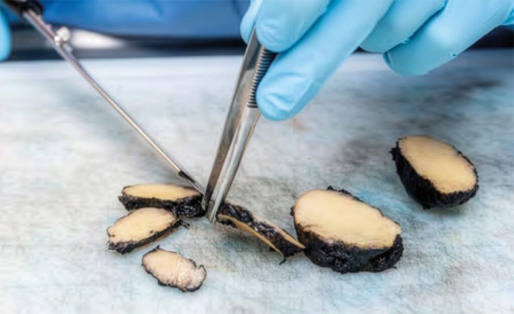 Snijden van coupures van (verdacht) kankerweefsel