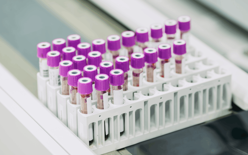 Article image of: Hoe het Erasmus MC zijn laboratoria samenbrengt in één geautomatiseerde labstraat