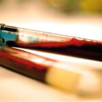 Article image of: Vroege bloedtest voor Parkinson