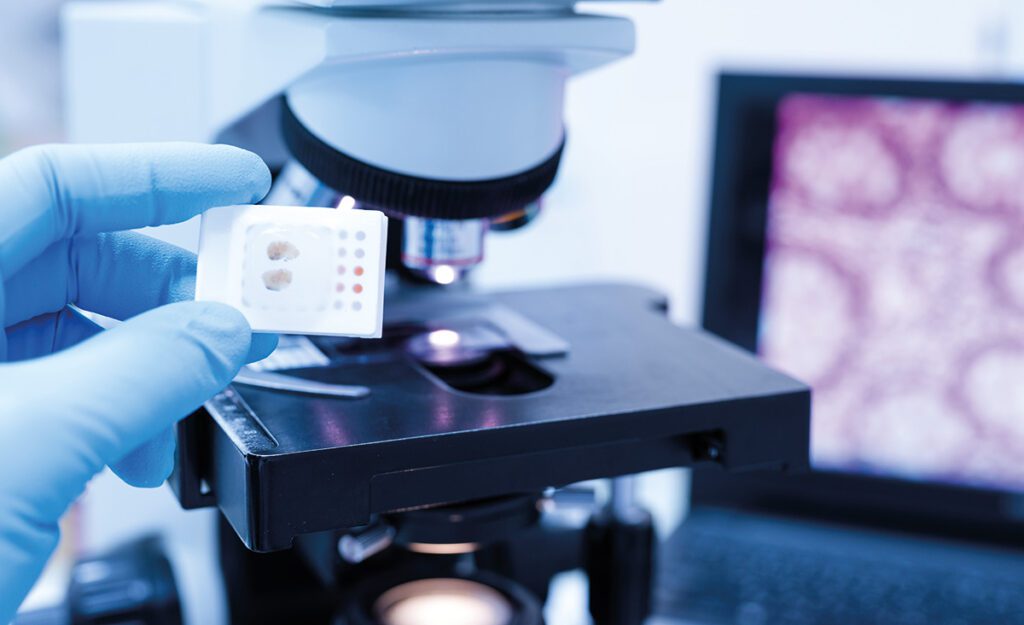 Article image of: Pathologisch onderzoek profiteert van kunstmatige intelligentie