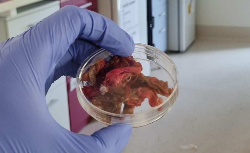 Verbrande huid in een petrischaal op het lab in Perth